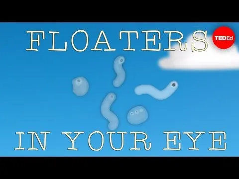 What are those floaty things in your eye?